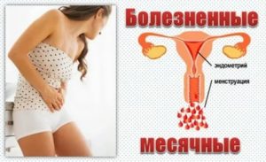Почему иногда месячные проходят болезненно а иногда нет