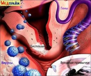 К чему приснилось что у меня рак матки