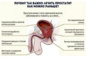 Можно ли забеременеть что мужчины если у него хронический простатит