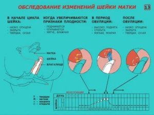 Можно делать конизацию шейки матки перед месячными