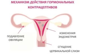 Можно ли отсрочить месячные противозачаточными таблетками с середины цикла