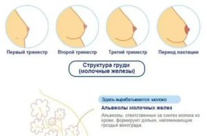 Почему набухает и болит грудь во время месячных