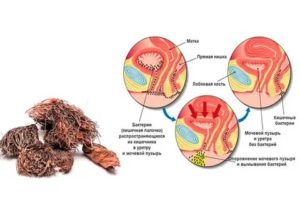 Как принимать красную щетку при цистите