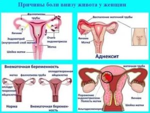 Почему во время месячных ломит кости