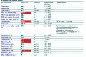 Могут ли повысится тромбоциты перед месячными