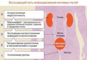 Как можно заразиться циститом от мужчины