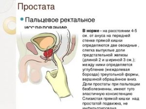 Положение для пальпации предстательной железы