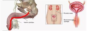 Могут при простатите быть красные губки уретры