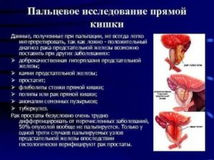 Рвота кровью при раке предстательной железы