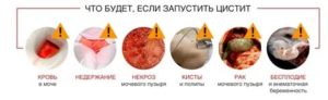 Почему не проходит острый цистит