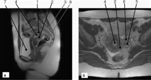 Что показывает мрт матки и придатков