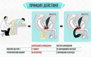 Можно ли заниматься сексом во время лечения простатита антибиотиками