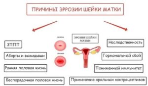 Что такое молочница хламидиоз эрозия шейки матки