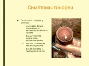 Можно ли заразиться венерическими от мочи