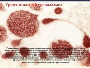 Может ли через слюну передаться уреаплазмоз