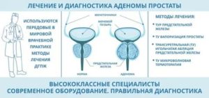 Озонотерапия при лечении аденомы простаты