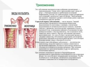 Что такое трихомонадный вагинит и чем это лечится