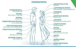 Как называются онкомаркеры матки