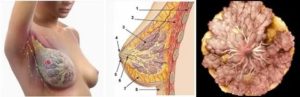 Как протекает рак молочной железы у пожилых женщин