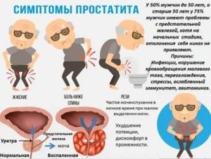 Увеличена простата в 2 раза как лечить хронический простатита у мужчин