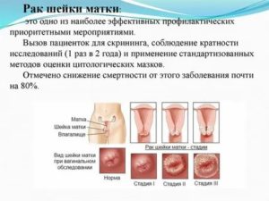 Что такое распад опухоли рака шейки матки