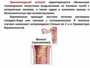 Что такое трихомонадный вагинит и чем это лечится