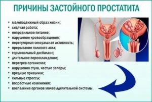 Признаки конгестивного простатита что это такое