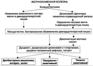 Чем лечить цистит при панкреатите