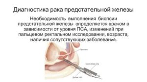 Точные методы исследования предстательной железы