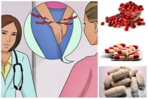 Почему при цистите нельзя есть шоколад