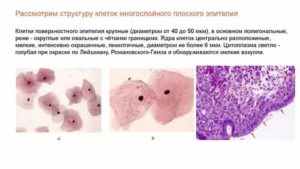 Цитология шейки матки клетки плоского эпителия промежуточного слоя