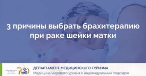 Брахитерапия рака шейки матки отзывы специалистов