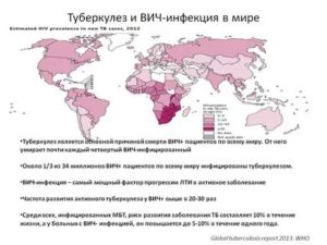 Сколько живут с туберкулезом и вич инфекцией