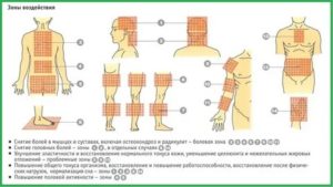 Как применять аппликатор кузнецова при простатите