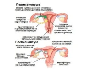 Может ли тироксин повлиять на задержку месячных