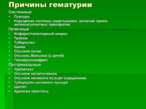 Гематурия виды причины диагностика лечение