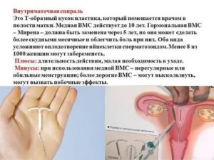 Плюсы и минусы гинекологической спирали