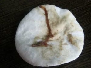 Почему болит грудь и коричневые выделения после месячных