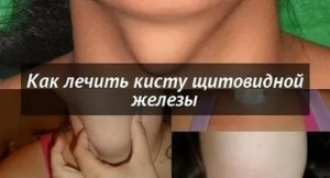 Почему болит щитовидка перед месячными