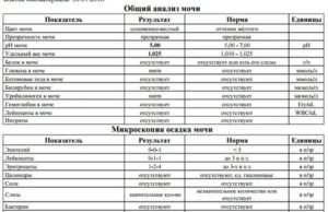 Слизь в моче у мужчин при простатите