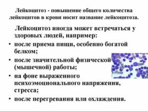 При простатите может быть повышенный уровень лейкоцитов