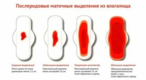 Почему сбой месячных после родов