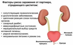 Как можно заразиться циститом от мужчины