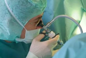 Трансуретральная резекция предстательной железы отзывы