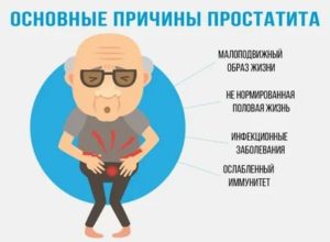 Симптомы простатита у женщин симптомы и лечение