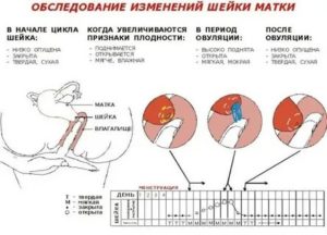 Почему может быть увеличена матка у женщины перед месячными