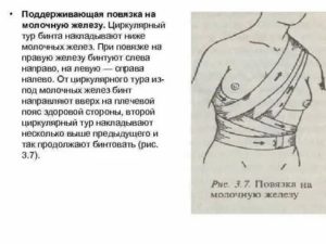 Какие нужны бинты на операцию молочной железы