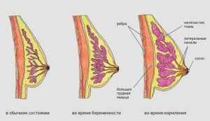 Как увеличивается соски у женщин при эрекции