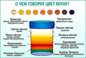 Моча темного цвета при простатите