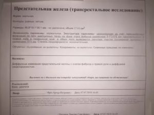 Предстательная железа эхоструктура неоднородная контур четкий